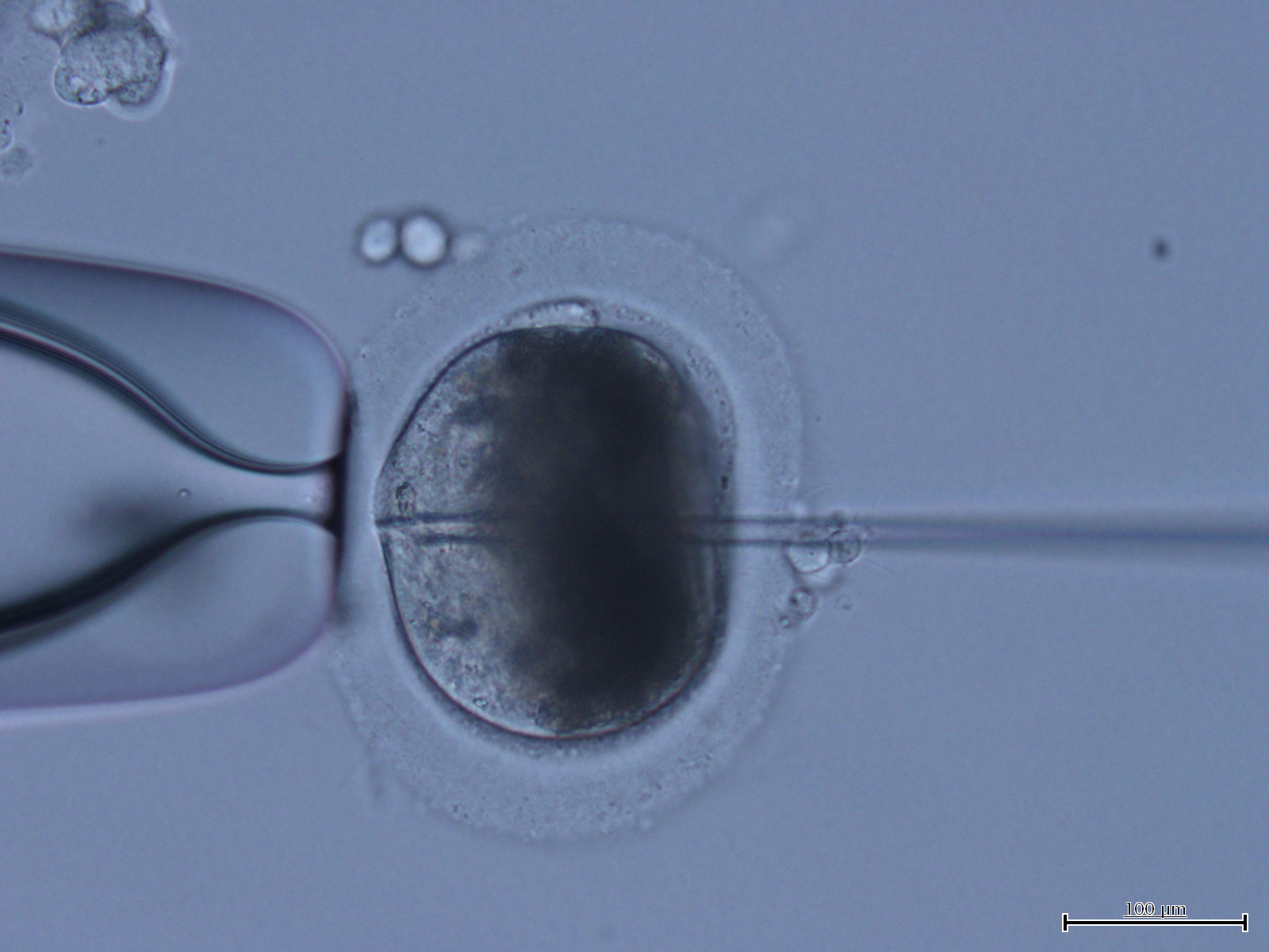 Microscopy image of equine oocyte during ICSI procedure