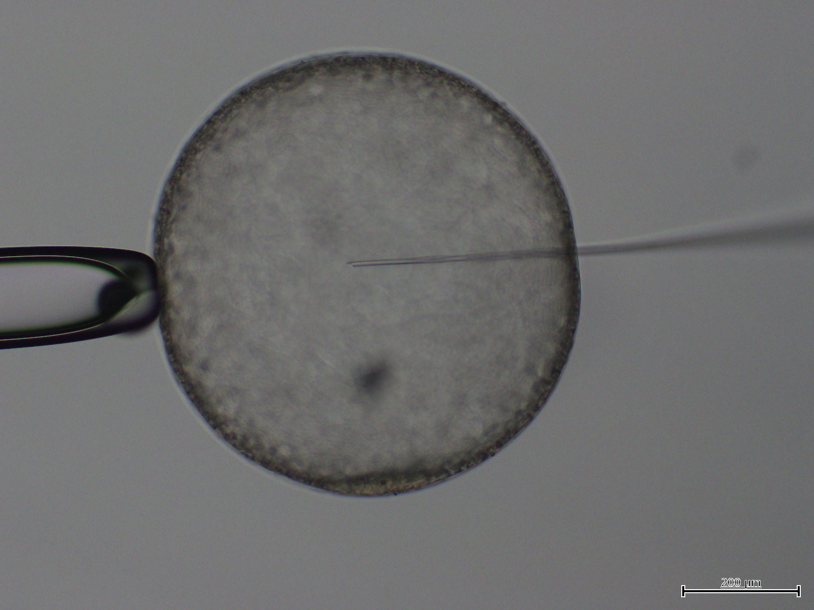 ICSI procedure: injection needle entering oocyte under microscope